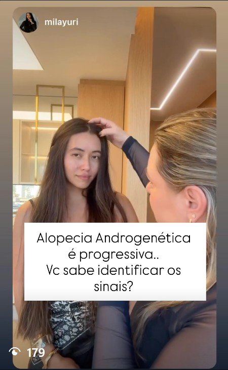 Conteúdo educativo sobre sinais da alopecia androgenética
