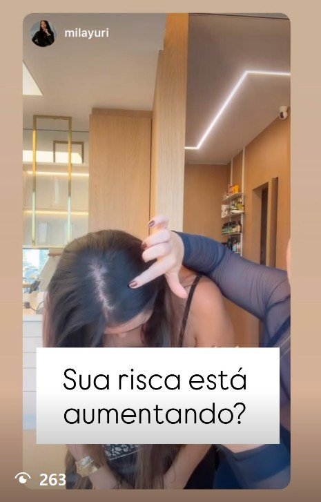 Sinal de calvície feminina com aumento da risca central